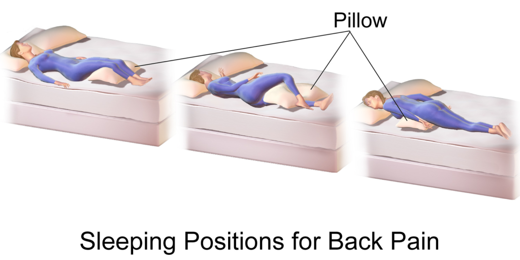 best sleeping positions for back pain