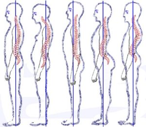 spine posture - proper posture