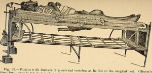 history of spinal injury treatments