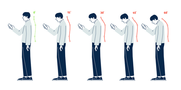 Text neck. Phone using posture. Neck position, ergonomic infographic for people gadget addiction. 