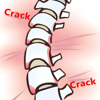 spine crack
