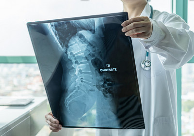 imaging looking for spinal infection